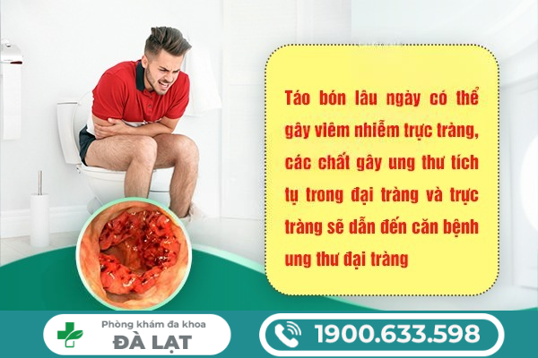 Hình ảnh minh họa